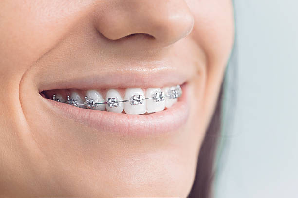 Best Tooth Extraction  in Gahanna, OH